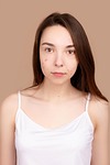 blemish, acne, pimple, remove